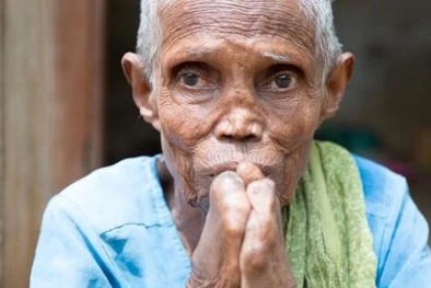 बिहार : कुष्ठ पीड़ितों को प्रतिमाह मिलेगी तीन हजार रुपये पेंशन