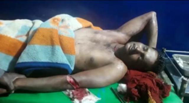 सुपौल:- पूर्व के पैसे कर्ज रखने कारण किया जख्मी