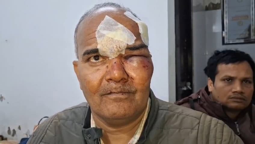 बिहार में बिजली विभाग के अधिकारियों पर जानलेवा हमला, लाठी-डंडों से पीट-पीटकर किया लहूलुहान